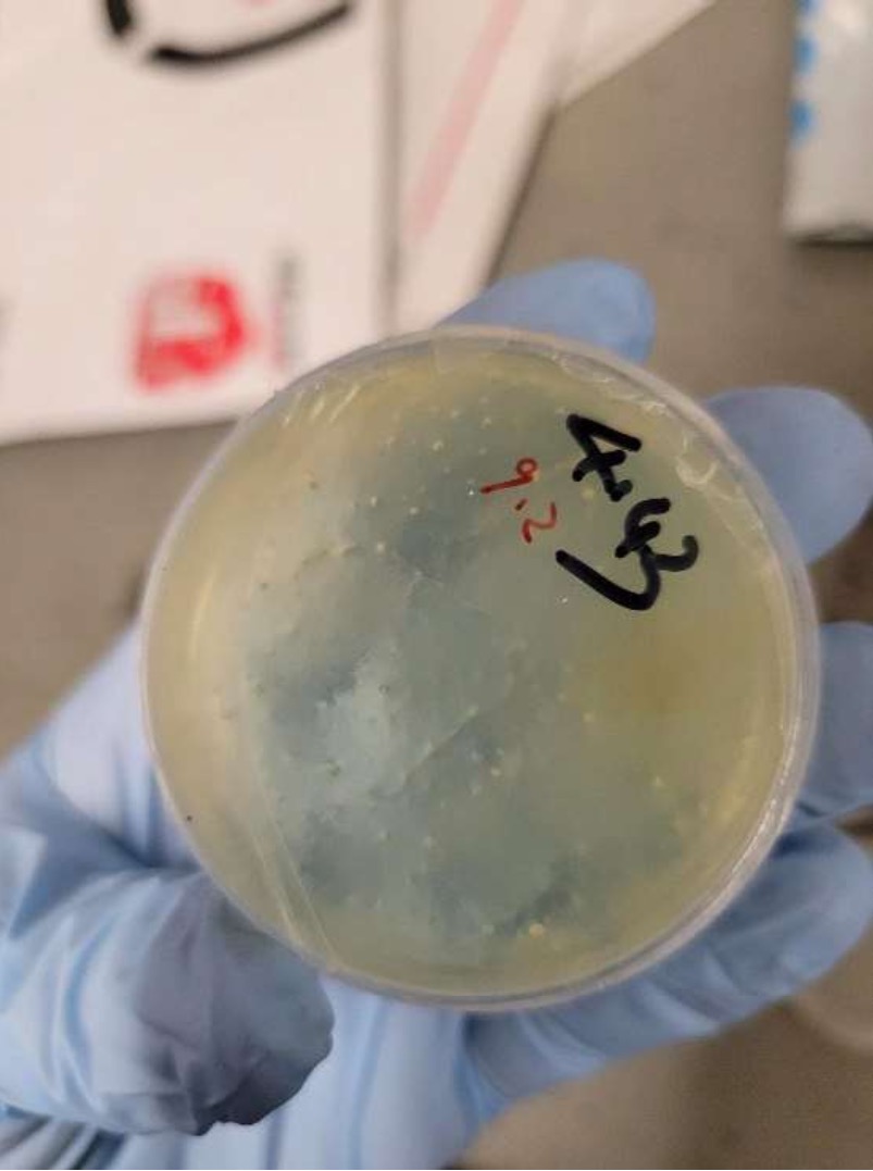 Petri dish with biological material.